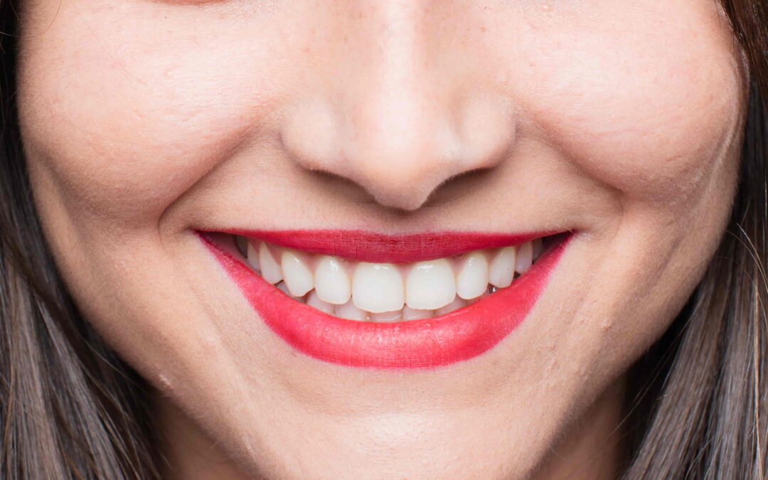 Brighter Smile, Brighter Confidence: Unveiling the Benefits of Professional Teeth Whitening
