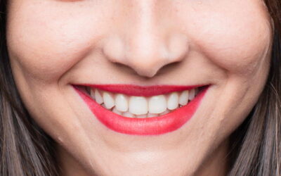 Brighter Smile, Brighter Confidence: Unveiling the Benefits of Professional Teeth Whitening