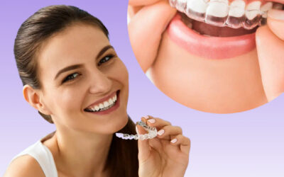 Transform Your Smile with Clear Aligners: Everything You Need to Know