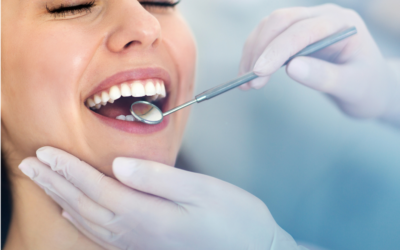 Top 5 Benefits of Porcelain Veneers for a Stunning Smile