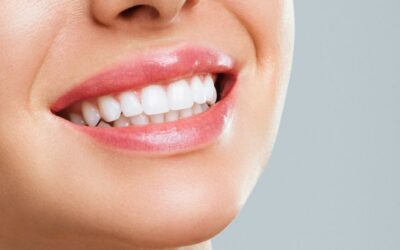 Transform Your Smile with Clear Aligners from Diamond Dental Bundoora