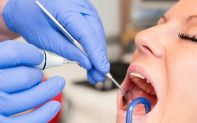 Why Regular Dental Checkups Matter: Insights from Diamond Dental Bundoora